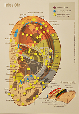 Ohr Akupunktur Karte